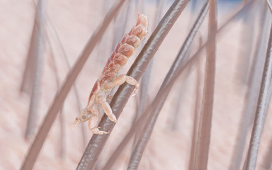 3d rendered illustration of a head louse on a human head