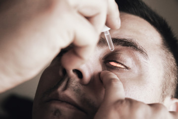 Man is putting drops in his eyes. Medical treatment concept. Allergic conjunctivitis problem.