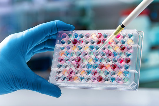 Scientist hand holding microplate for biomedical research / Researcher holding a 96 well plate with samples for biological analysis