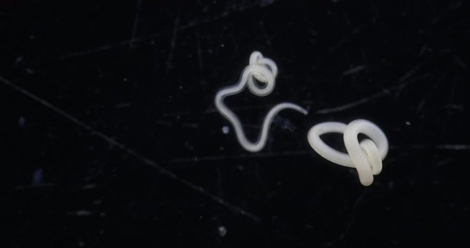 Study  Ascarid nematode of the phylum Nematoda, it is the most common parasitic worm in crab for laboratory testing.