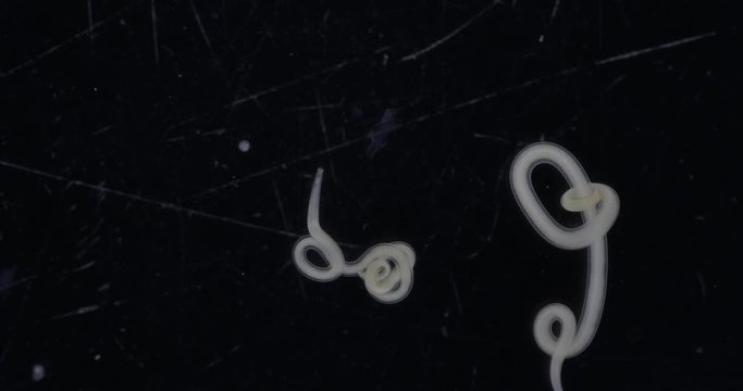 Study  Ascarid nematode of the phylum Nematoda, it is the most common parasitic worm in crab for laboratory testing.