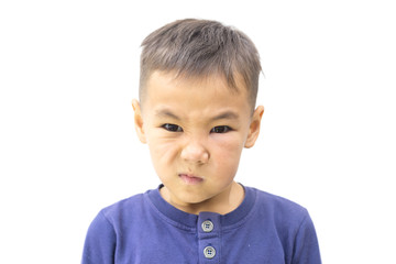 eye injury, boy with a puffy eye, isolated on white. after the fight with my brother.