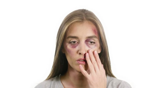 portrait of a woman on a white background, with traces of domestic violence, bruises of sadina s bruises from her nose. the girl s blood is touching and with her hand and looks at the camera
