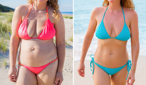Candid photos of woman before and after successful diet