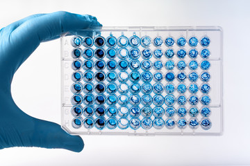 Researcher holding microplate for biomedical research /Scientist holding a 96 well plate with samples for biological analysis