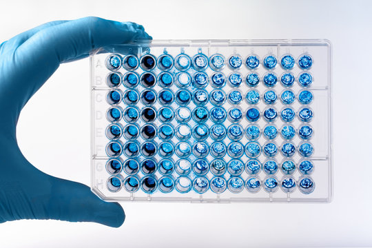 Researcher holding microplate for biomedical research /Scientist holding a 96 well plate with samples for biological analysis