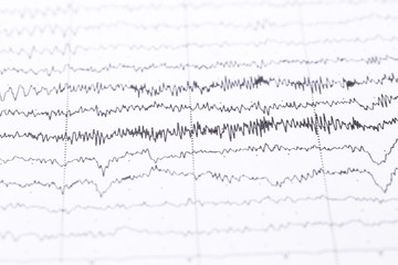 Cardiogram on a sheet of paper close-up. Texture of pulsed waves.