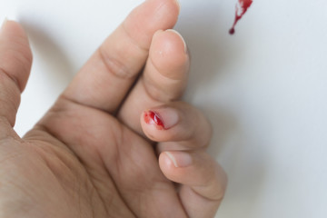 Red blood from finger, Accidents always happen.