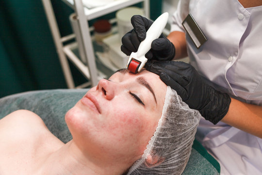 Doctor cosmetologist makes facial massage procedure using a dermo roller. Woman in beauty salon during mesotherapy procedure with mesoscooter