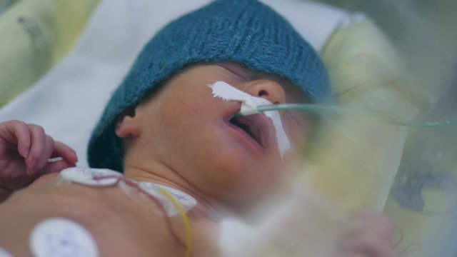 Newborn baby with tubes in infant incubator.