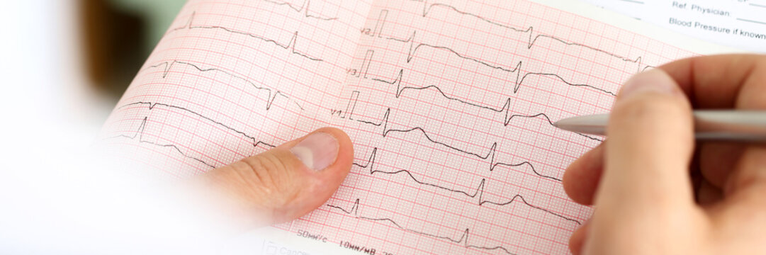 Male medicine doctor hands holding cardiogram chart
