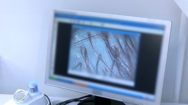 Trichoscopy Bilder – Durchsuchen 248 Archivfotos, Vektorgrafiken und ...