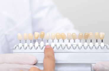 Palette with shades of teeth. Dental samples of tint teeth