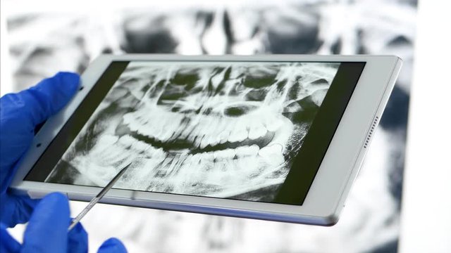 The dentist uses a tablet with an image of the x-ray of the jaw. Bite diagnosis, braces system and modern medical technologies.