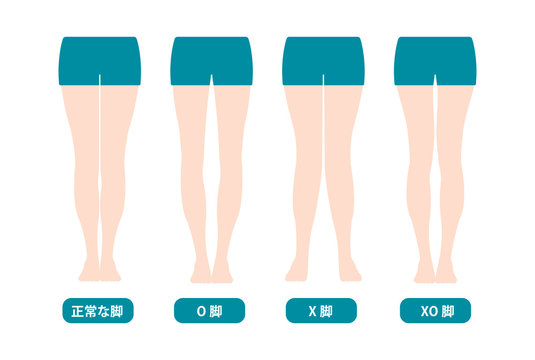 Difference types of  legs angles and knees vector illustration (Japanese) 