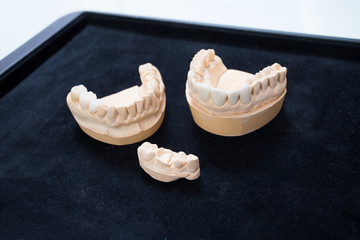 Ceramic teeth on a plaster model on a black background