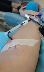 arm of donor during the blood donation