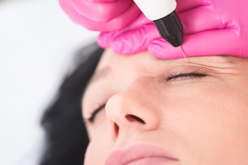 Cystic lesions, hyperpigmentation, palpebral ptosis, palpebrarum, plexr device, xanthelasma, blepharoplasty