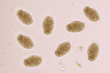 Eggs of Hookworm in human stool, analyze by microscope, original magnification 400x