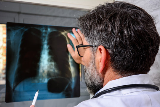 healthcare, medical and radiology concept - senior  doctor looking at x-ray. Doctor examining at lungs radiograph x-ray film of patient