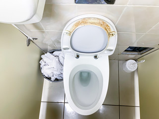 Dirty unhygienic seat of a toilet bowl with limescale stain at public restroom close up