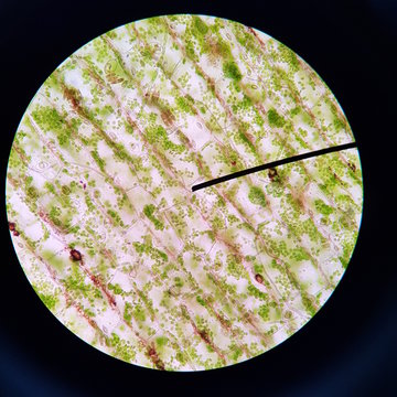 Plasmolysis