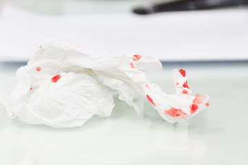 Blood on the table tissue