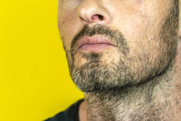 Fototapeta premium portrail of caucasian man with Little beard and dry lips in yellow background