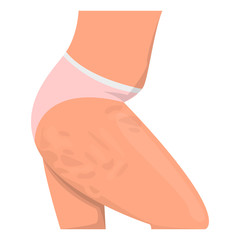 Cellulite on the hips vector isolated. Female body