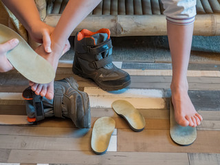 Beautiful bare children's feet with therapeutic orthopedic insoles for shoes on a wooden parquet background. Flatfoot treatment. Closeup of little male barefoot legs