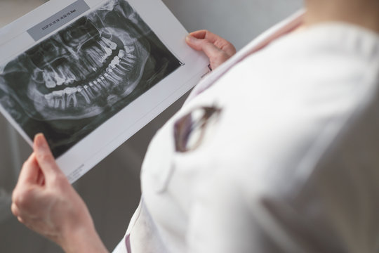 Female dentist looking at x-ray image.