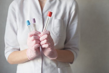 Nurse holds tubes for blood test. Close-up view