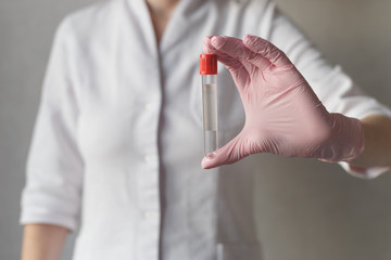 Nurse holds tubes for blood test. Close-up view