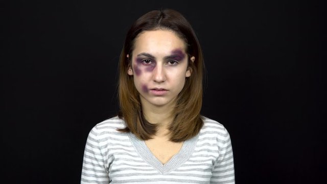 Young woman cries covering her face with hands. A woman with bruises on her face. Quarrels in a young family. Domestic violence. On a black background