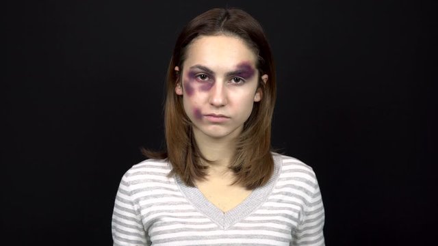 A young woman takes off her sunglasses to show bruises on her face. A woman with bruises on her face. Quarrel in a young family. Domestic violence. On a black background