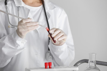 Woman working with blood sample in laboratory, closeup