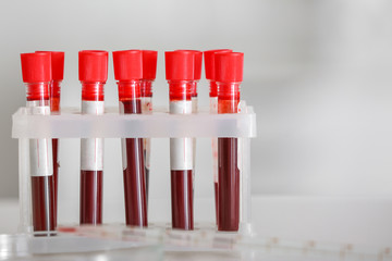 Test tubes with blood samples on table in laboratory