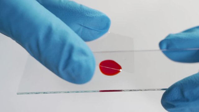 blood test. pipette with drop of blood