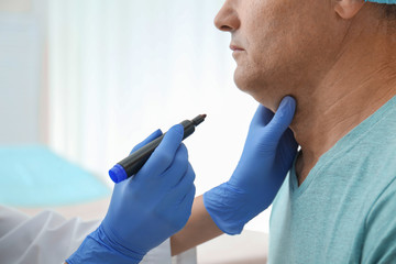 Surgeon with marker preparing man for operation in clinic, closeup. Double chin removal - obrazy, fototapety, plakaty