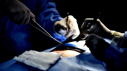 Medical Team Performing Surgical Operation in Modern Operating Room. Equipment and medical devices in hybrid operating room.scrub nurse preparing medical instruments for operation.