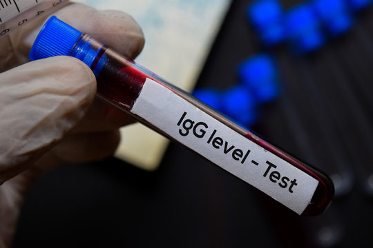 IgG level - Test text with blood sample. Top view isolated on black background. Healthcare/Medical concept