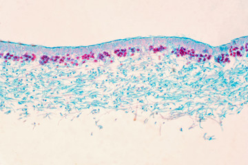 Lichen, Fungus, cross section slide under the microscope view.