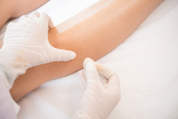 Fototapeta na wymiar Therapy of female leg with pricking acupuncture needles