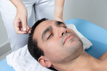 Fototapeta na wymiar Therapist adjusting acupuncture needles on man head in aculpulture treatment.