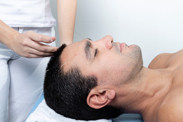 Obraz na płótnie Canvas Therapist adjusting acupuncture needles on man head in aculpulture treatment.