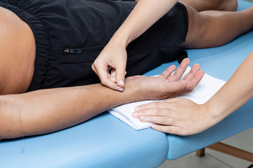 Fototapeta na wymiar Detail of therapist adjusting acupuncture needles on man hand in aculpulture treatment.