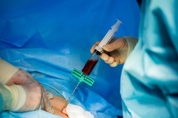Plasma in syringe. Specialist makes injection with syringe. Profeccional treatment. Health care...