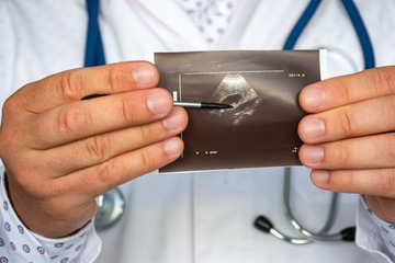 Doctor examines x-ray scan of knee near computer during work and patient appointment in office. On -ray clearly shows both the anatomical joint parts of the knee joint and the patella