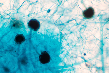 Rhizopus bread mold under the microscope.