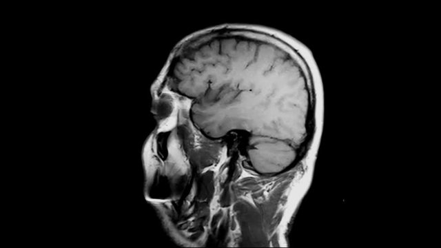 Human Brain MRI Scan,  X-ray - Magnetic Resonance imaging of a brain, Ultra HD 4k, Time Lapse